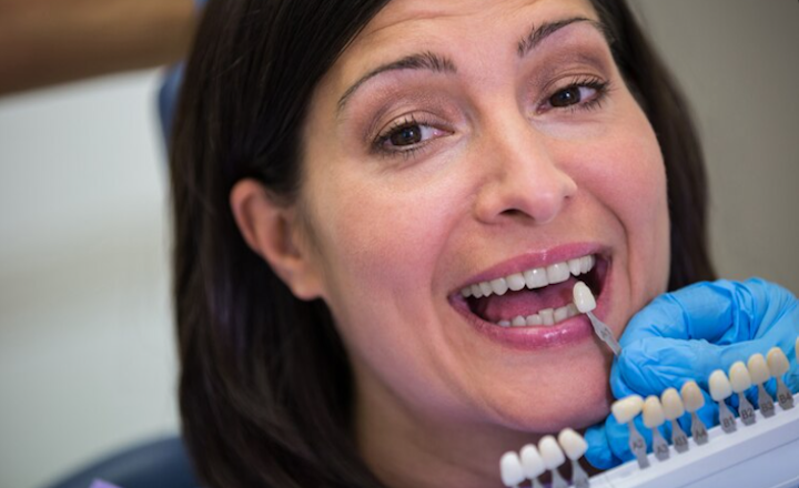 Porcelain Veneers Explained: What They Are and What the Process May Involve Porcelain Veneers Explained: What They Are and What the Process May Involve
